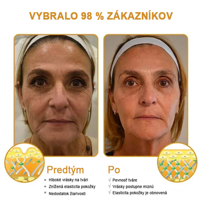 🍀Posledný deň akcie: 70% zľava - ✨Furzero™ Botoxový krém na odstránenie vrások od včelieho jedu