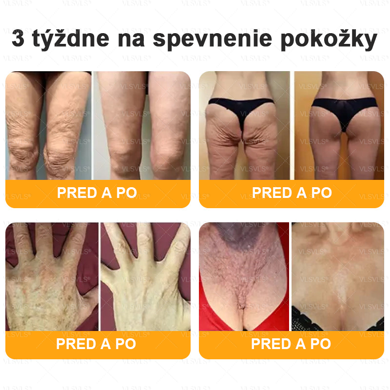Zostáva už len 5 boxov Ponúkame vám extra 50% zľavu🔥 Buďte fit a do budúceho roka nebudete mať šancu!