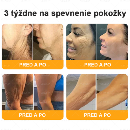 Zostáva už len 5 boxov Ponúkame vám extra 50% zľavu🔥 Buďte fit a do budúceho roka nebudete mať šancu!