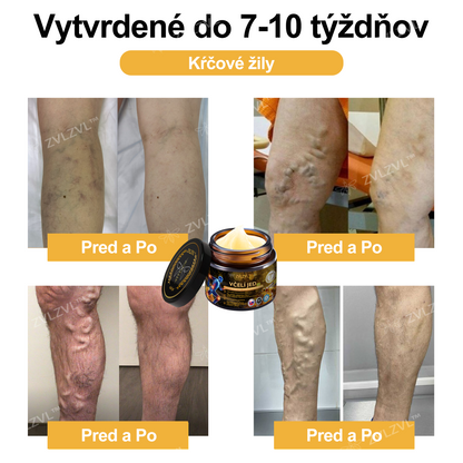 𝐎𝐟𝐢𝐜𝐢á𝐥𝐧𝐲 𝐨𝐛𝐜𝐡𝐨𝐝:𝐙𝐕𝐋𝐙𝐕𝐋™ 🐝𝐕č𝐞𝐥í 𝐣𝐞𝐝 𝐨𝐤𝐚𝐦ž𝐢𝐭ý 𝐮𝐥𝐭𝐫𝐚 𝐬𝐢𝐥𝐧ý 𝐤𝐫é𝐦 𝐩𝐫𝐨𝐭𝐢 𝐛𝐨𝐥𝐞𝐬𝐭𝐢 - (𝐳𝐦𝐢𝐞𝐫ň𝐮𝐣𝐞 𝐛𝐨𝐥𝐞𝐬ť 𝐩𝐫𝐢 𝐚𝐫𝐭𝐫𝐢𝐭í𝐝𝐞, 𝐛𝐨𝐥𝐞𝐬𝐭𝐢 𝐬𝐯𝐚𝐥𝐨𝐯, 𝐜𝐡𝐫𝐛𝐭𝐚, 𝐤𝐨𝐥𝐢𝐞𝐧, 𝐜𝐡𝐫𝐛𝐭𝐚, 𝐫𝐚𝐦𝐢𝐞𝐧, 𝐛𝐨𝐤𝐨𝐯, 𝐳á𝐩ä𝐬𝐭í, 𝐫ú𝐤)