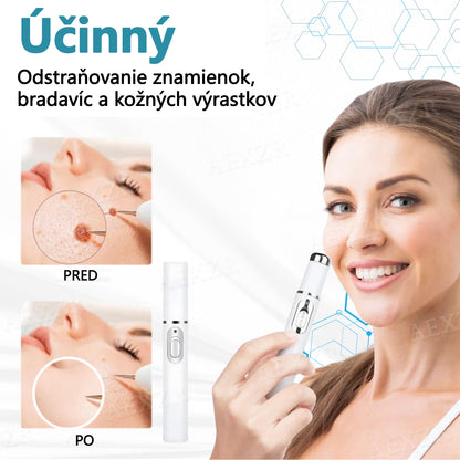 🎉 50 % zľava len na obmedzený čas!  Bikenda® Neinvazívne laserové pero  Bezbolestné odstránenie znamienok, bradavíc a škvŕn priamo u vás doma! 💕ie znamienok, bradavíc a škvŕn priamo u vás doma! 💕