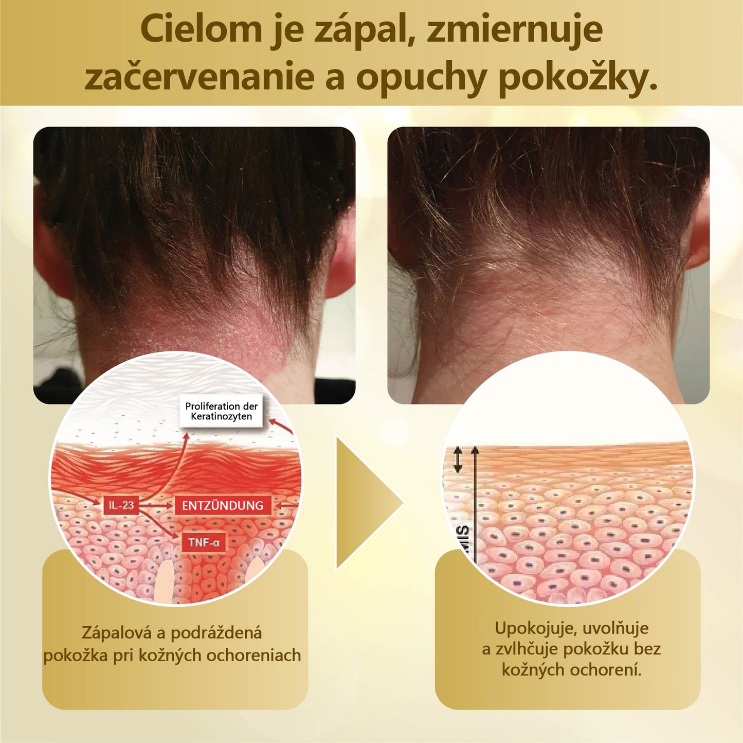 Regeneračný krém Croaie® Condense Mellifera Venom🔥