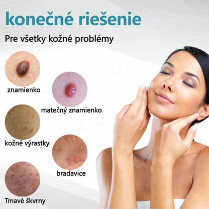 🎉 50 % zľava len na obmedzený čas!  Bikenda® Neinvazívne laserové pero  Bezbolestné odstránenie znamienok, bradavíc a škvŕn priamo u vás doma! 💕ie znamienok, bradavíc a škvŕn priamo u vás doma! 💕