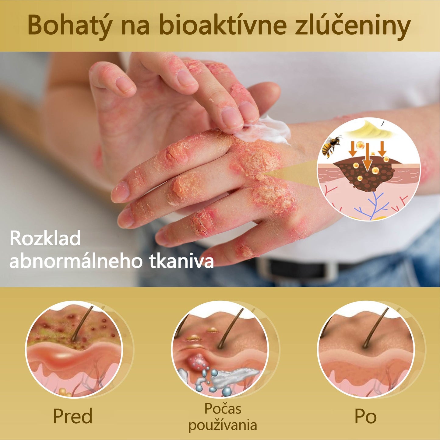 Regeneračný krém Croaie® Condense Mellifera Venom🔥